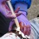 Applicateur pour blessure hémostatique Celox®